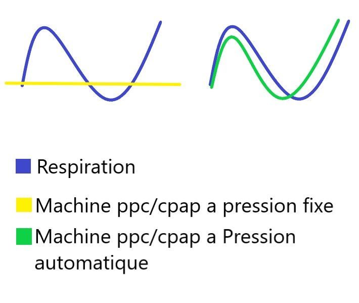 Schema Cpap